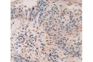 Figure. (QSOX1 抗体  (AA 394-519))