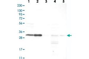Western blot analysis of Lane 1: RT-4, Lane 2: U-251 MG, Lane 3: Human Plasma, Lane 4: Liver, Lane 5: Tonsil with SLC25A22 polyclonal antibody  at 1:250-1:500 dilution. (SLC25A22 抗体)