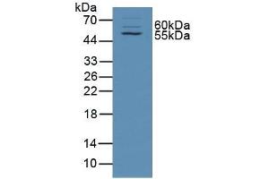 Detection of TXLNa in Rat Skin Tissue using Polyclonal Antibody to Taxilin Alpha (TXLNa) (alpha Taxilin 抗体  (AA 1-234))