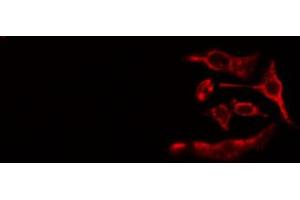 ABIN6267522 staining Hela cells by IF/ICC. (ZAP70 抗体  (pTyr493))