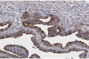 ABIN6267299 at 1/200 staining human Fallopian tube sections by IHC-P. (Integrin beta 3 抗体  (pTyr773))