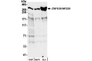 anti-Zinc Finger Protein 638 (ZNF638) (AA 225-275) antibody