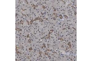 Immunohistochemical staining of human pancreas with FAM219A polyclonal antibody  shows ditinct positivity in intercalated ducts. (C9orf25 抗体)