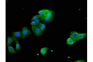 Immunofluorescent analysis of HepG2 cells using ABIN7170709 at a dilution of 1:100 and Alexa Fluor 488-congugated AffiniPure Goat Anti-Rabbit IgG(H+L) (STARD9 抗体  (AA 1960-2180))