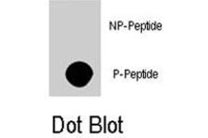 Dot blot analysis of AKT3 (phospho S472) polyclonal antibody  on nitrocellulose membrane. (AKT3 抗体  (pSer472))