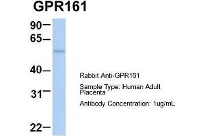 Host:  Rabbit  Target Name:  GPR161  Sample Type:  Human Adult Placenta  Antibody Dilution:  1. (GPR161 抗体  (Middle Region))