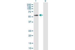 Western Blotting (WB) image for anti-Cytochrome P450, Family 2, Subfamily E, Polypeptide 1 (CYP2E1) (AA 1-493) antibody (ABIN514836)