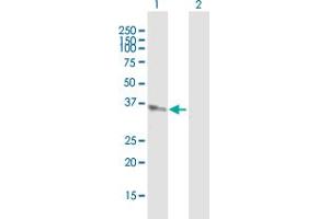 Western Blot analysis of AKR1C4 expression in transfected 293T cell line by AKR1C4 MaxPab polyclonal antibody. (AKR1C4 抗体  (AA 1-323))