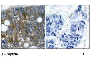 Image no. 1 for anti-Heat Shock 27kDa Protein 1 (HSPB1) (pSer15) antibody (ABIN196894) (HSP27 抗体  (pSer15))