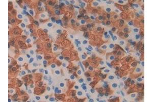 Detection of FBLN1 in Rat Stomach Tissue using Polyclonal Antibody to Fibulin 1 (FBLN1)