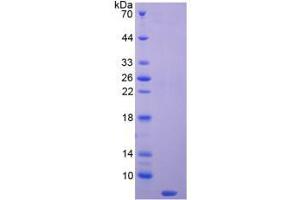 SDS-PAGE analysis of Mouse Thymosin beta 4 Protein. (TMSB4X 蛋白)