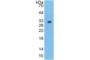 Western Blotting (WB) image for Mannose-Binding Lectin (Protein C) 2, Soluble (MBL2) ELISA Kit (ABIN6574279)