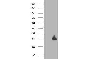 Western Blotting (WB) image for anti-Deoxythymidylate Kinase (Thymidylate Kinase) (DTYMK) antibody (ABIN1497918) (DTYMK 抗体)