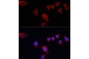 Immunofluorescence (IF) image for anti-Carbonic Anhydrase IX (CA9) (AA 52-151) antibody (ABIN6137798)