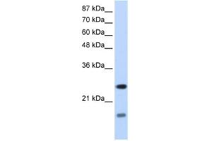 WB Suggested Anti-SRAntibody Titration:  1. (SRP14 抗体  (N-Term))