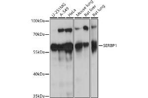 Western blot analysis of extracts of various cell lines, using SERBP1 antibody (ABIN7270252) at 1:1000 dilution.