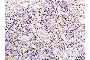 Immunohistochemistry (Paraffin-embedded Sections) (IHC (p)) image for anti-CD19 Molecule (CD19) (AA 485-556) antibody (ABIN724595)