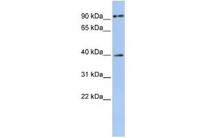 WB Suggested Anti-MAGEA6 Antibody Titration:  0. (MAGEA6 抗体  (Middle Region))