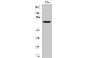 Western Blotting (WB) image for anti-Eukaryotic Translation Initiation Factor 2-alpha Kinase 2 (EIF2AK2) (Thr392) antibody (ABIN3176940) (EIF2AK2 抗体  (Thr392))