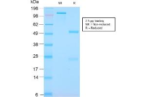 SDS-PAGE Analysis Purified S100A8/A9 Complex Recombinant Rabbit Monoclonal (MAC3157R). (Recombinant S100A8 抗体)