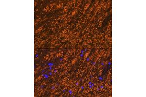 Immunofluorescence analysis of rat brain cells using PLP1 Rabbit pAb (ABIN7269724) at dilution of 1:100 (40x lens). (PLP1 抗体  (AA 145-210))