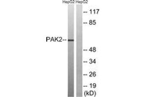 Western blot analysis of extracts from HepG2 cells, treated with serum 20% 15', using PAK2 (Ab-192) Antibody. (PAK2 抗体  (AA 158-207))