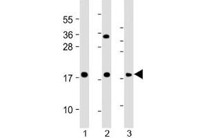 Western blot testing of human 1) HeLa, 2) THP1 and 3) RPMI 8226 cell lysate with GPX7 antibody at 1:2000. (Glutathione Peroxidase 7 抗体  (AA 73-107))