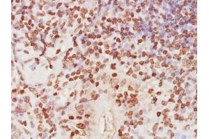 Paraformaldehyde-fixed, paraffin embedded mouse small intestine, Antigen retrieval by boiling in sodium citrate buffer (pH6) for 15min, Block endogenous peroxidase by 3% hydrogen peroxide for 30 minutes,  Blocking buffer (normal goat serum) at 37°C for 20min, Antibody incubation with RPA32 Polyclonal Antibody (bs-4182R) at 1:400 overnight at 4°C, followed by a conjugated secondary and DAB staining. (RPA2 抗体  (AA 101-200))