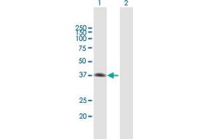 Western Blot analysis of MAD2L1BP expression in transfected 293T cell line by MAD2L1BP MaxPab polyclonal antibody. (MAD2L1BP 抗体  (AA 1-306))