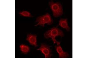 ABIN6275855 staining HeLa by IF/ICC. (STK33 抗体  (N-Term))