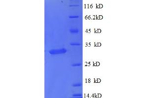 Metallothionein 1X (MT1X) (AA 1-59), (partial) protein (GST tag)