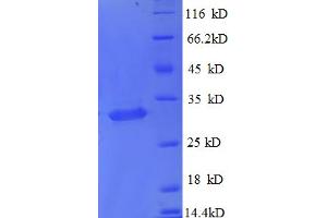 SDS-PAGE (SDS) image for Metallothionein 1X (MT1X) (AA 1-59), (partial) protein (GST tag) (ABIN4974710) (MT1X Protein (AA 1-59, partial) (GST tag))