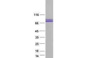 Validation with Western Blot
