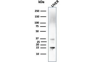 Western Blot Analysis of Liver tissue lysate using Transthyretin Mouse Monoclonal Antibody (CPTC-TTR-1). (TTR 抗体)