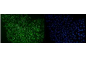 IF analysis of RANGAP1 using anti-RANGAP1 antibody (ABIN7600225). (RANGAP1 抗体  (AA 165-587))