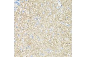 Immunohistochemistry of paraffin-embedded mouse brain using CD90/Thy1 antibody (ABIN7266228) at dilution of 1:100 (40x lens). (CD90 抗体  (AA 31-81))