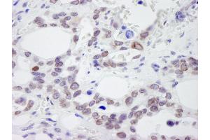 Immunohistochemistry (IHC) image for anti-Nucleoporin 214kDa (NUP214) (AA 1250-1300) antibody (ABIN7448921)