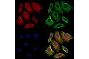 ABIN6264012 and ABIN6273286 staining Hela cells by IF/ICC. (PAFAH2 抗体  (Internal Region))