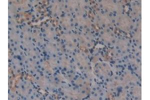 Immunohistochemistry (IHC) image for anti-DKK3 (AA 23-349) antibody (ABIN7443053)