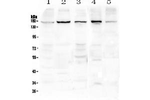 Western blot analysis of EEA1 using anti-EEA1 antibody . (EEA1 抗体)