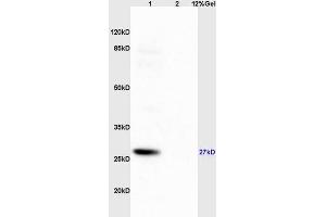 Lane 1: mouse brain lysates Lane 2: mouse pancreas lysates probed with Anti Phospho-S6 Ribosomal Protein (Ser235+Ser236) Polyclonal Antibody, Unconjugated (ABIN745583) at 1:200 in 4 °C. (RPS6 抗体  (pSer235, pSer236))
