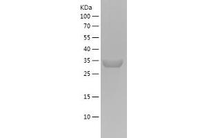 Actin Protein (AA 81-140) (His-IF2DI Tag)