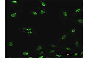 Immunofluorescence (IF) image for anti-Splicing Factor 3b, Subunit 2, 145kDa (SF3B2) (AA 1-636) antibody (ABIN949022)
