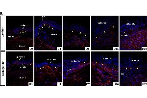 Immunofluorescence (Paraffin-embedded Sections) (IF (p)) image for anti-Collagen, Type IV (COL4) antibody (ABIN5596835)