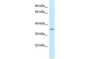 Image no. 1 for anti-Fumarylacetoacetate Hydrolase Domain Containing 2A (FAHD2A) (AA 28-77) antibody (ABIN6747792) (FAHD2A 抗体  (AA 28-77))