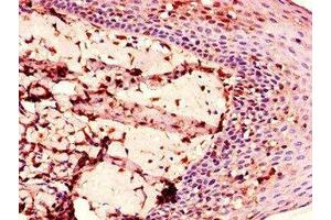 Immunohistochemistry of paraffin-embedded human tonsil tissue using ABIN7151381 at dilution of 1:100 (ENTPD8 抗体  (AA 30-434))