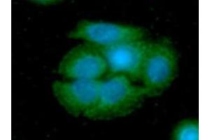 ICC/IF analysis of ARG2 in SW480 cells line, stained with DAPI (Blue) for nucleus staining and monoclonal anti-human ARG2 antibody (1:100) with goat anti-mouse IgG-Alexa fluor 488 conjugate (Green).