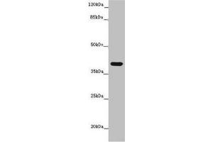 Western blot All lanes: MR1 antibody at 6 μg/mL + K562 whole cell lysate Secondary Goat polyclonal to rabbit IgG at 1/10000 dilution Predicted band size: 40, 35, 29, 26 kDa Observed band size: 40 kDa (MR1 抗体  (AA 150-253))
