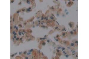 Used in DAB staining on fromalin fixed paraffin- embedded Kidney tissue (Endothelin 2 抗体  (AA 32-178))
