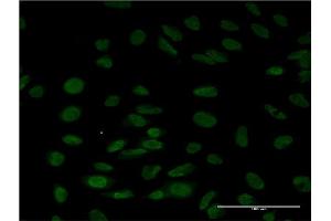 Immunofluorescence of monoclonal antibody to LSM6 on HeLa cell. (LSM6 抗体  (AA 1-80))